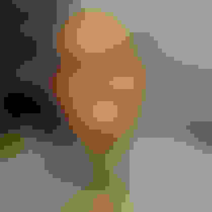 Carl had oral surgery at Oral Surgery Group