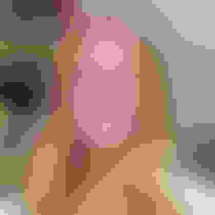 Diana had oral surgery at Oral Surgery Group