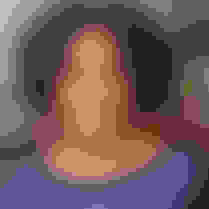 Jaqueline got a dental implant in East Brunswick, NJ