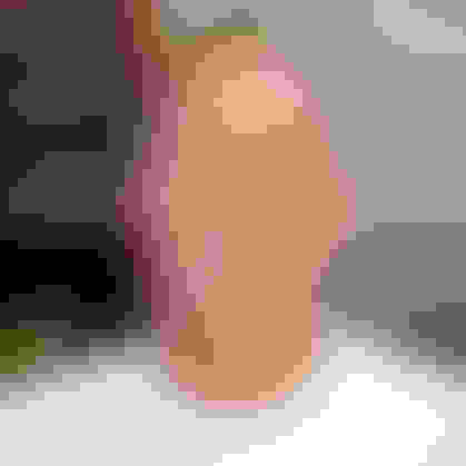 Ken had oral surgery at Oral Surgery Group