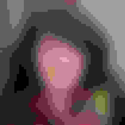 Leslie had oral surgery at Oral Surgery Group