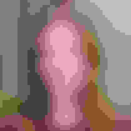 Linda had oral surgery at Oral Surgery Group