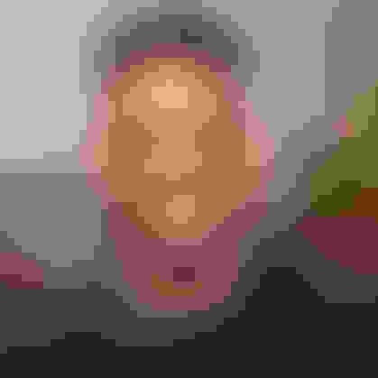 Malcom had oral surgery at Oral Surgery Group