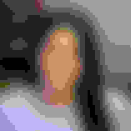 Marisa had oral surgery at Oral Surgery Group