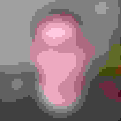 Max had his wisdom teeth removed in East Brunswick, NJ