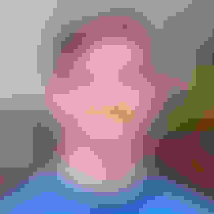 Richard had oral surgery at Oral Surgery Group