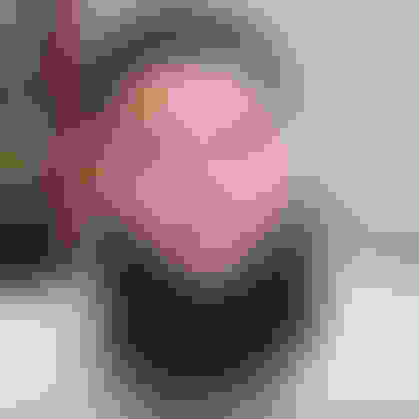 Richie had oral surgery at Oral Surgery Group