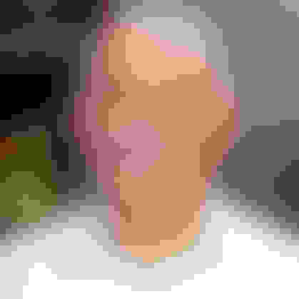 Stephen had oral surgery at Oral Surgery Group