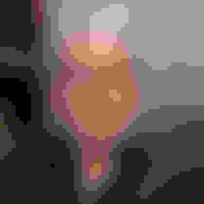 Steve had oral surgery at Oral Surgery Group