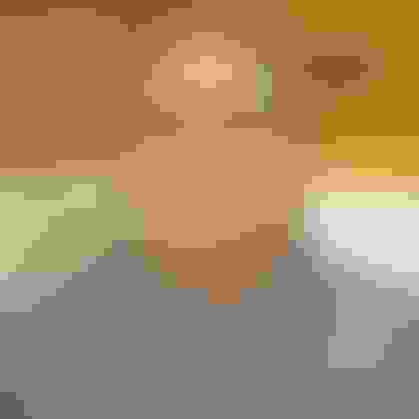 JD wisdom teeth removal  facewall