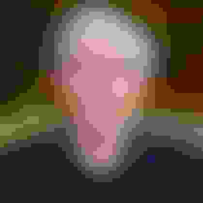 Rudy extraction dental implant  facewall