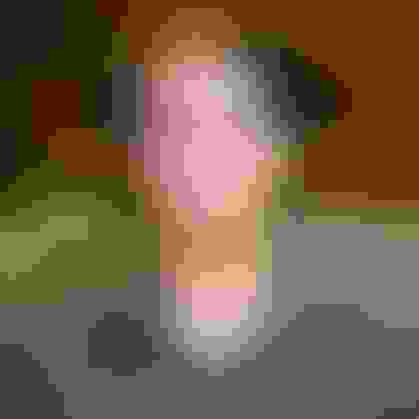 Christian wisdom teeth removal  facewall