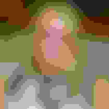 Lynn dental implant  facewall