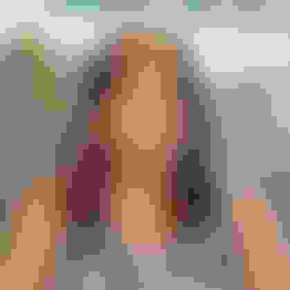 Michelle wisdom teeth removal mother  facewall