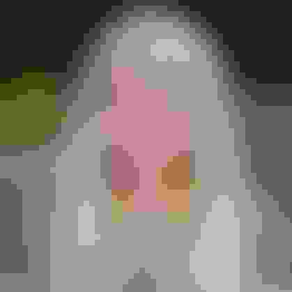 Samantha wisdom teeth removal  facewall