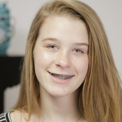 Olivia got braces in Omaha, NE