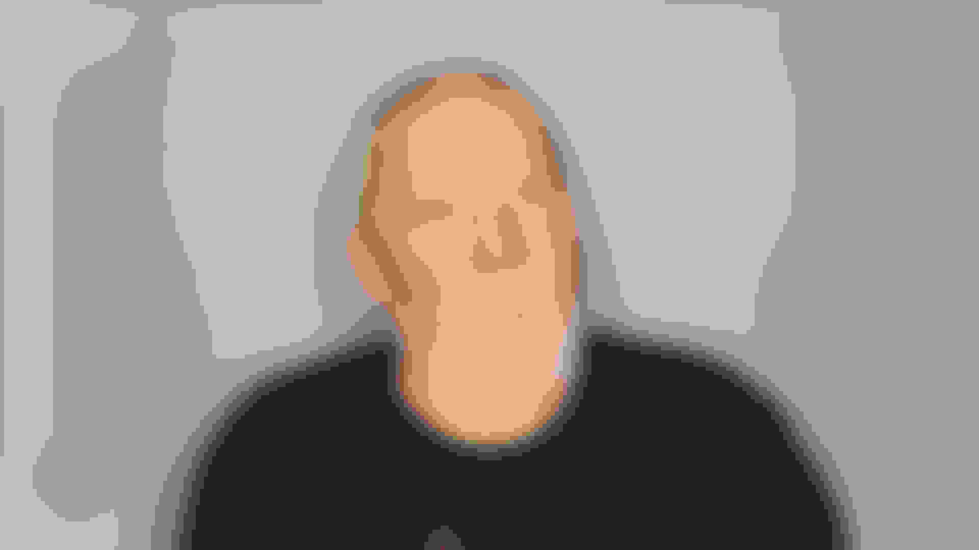 Jim zygomatic full arch desktop