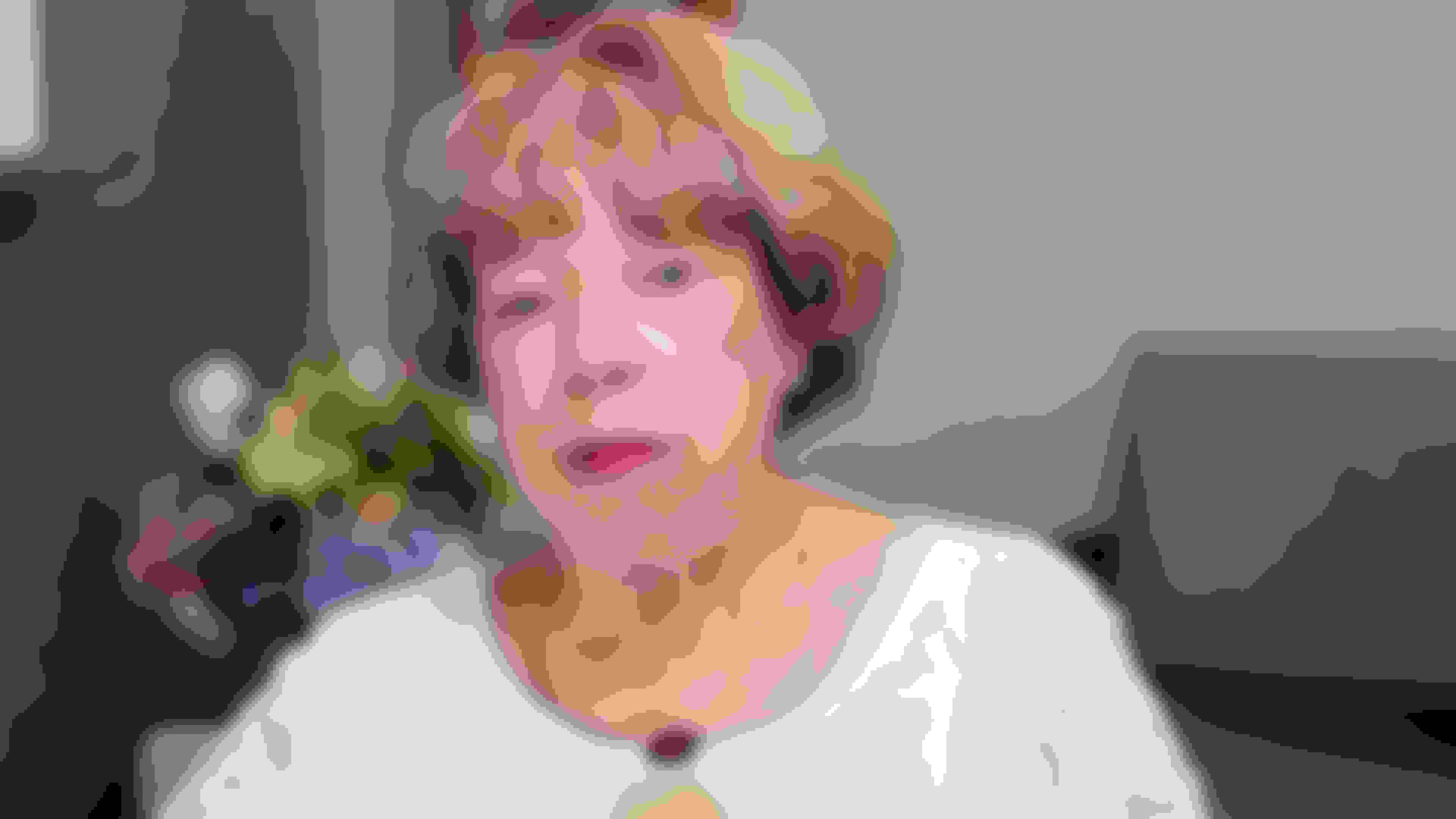 Norma had oral surgery at Oral Surgery Group