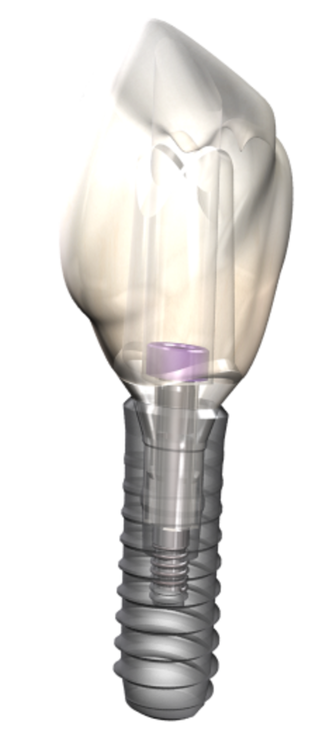 Isolated  dental implant