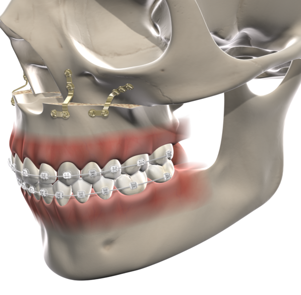 isolated  facial trauma  mobile