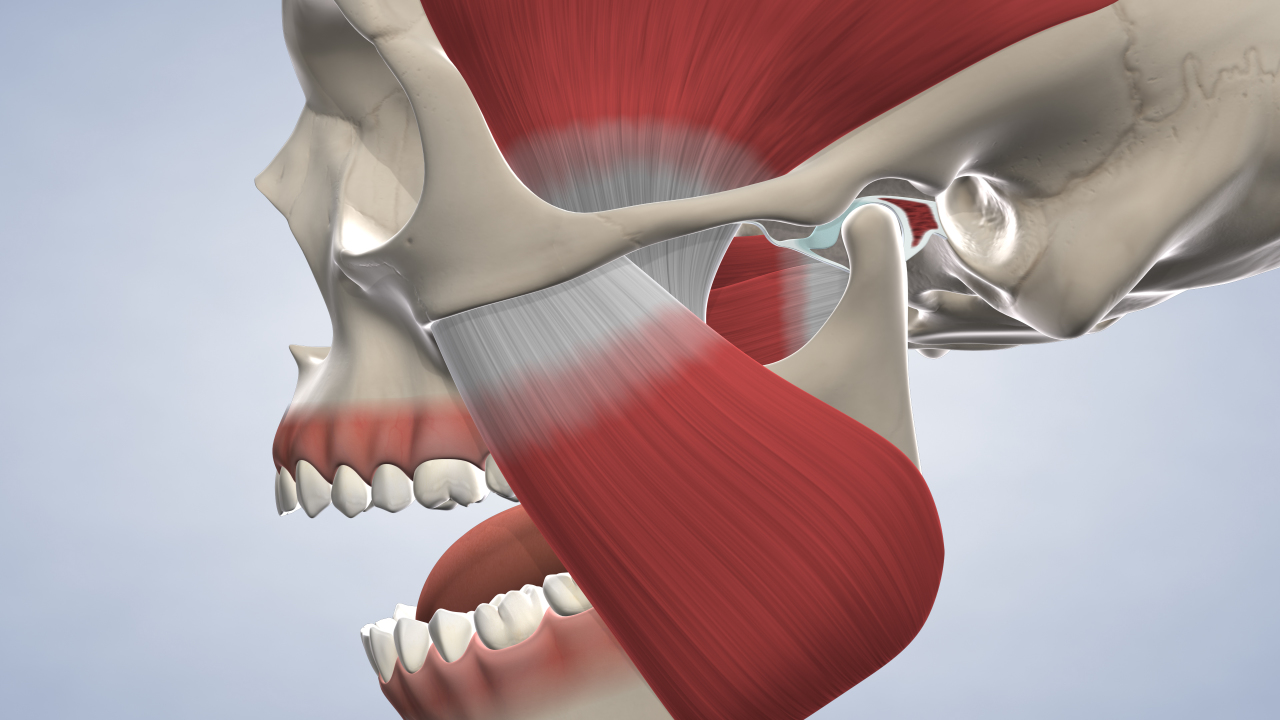 image of smile complete™ <br>full-arch restoration procedure