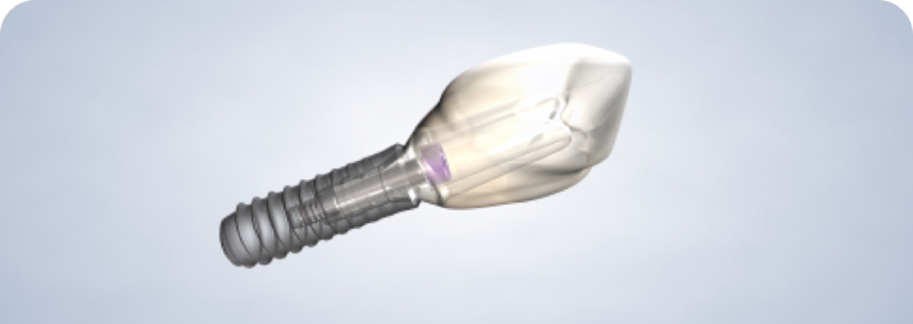 image of dental implants procedure