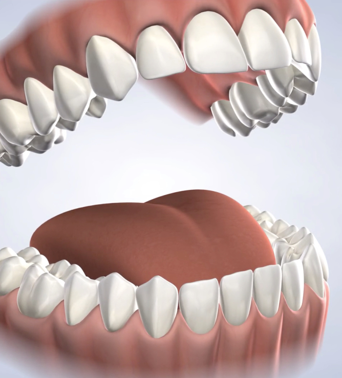 Oral Surgery Procedures In Boise Hailey And Star Id Cosmetic Services