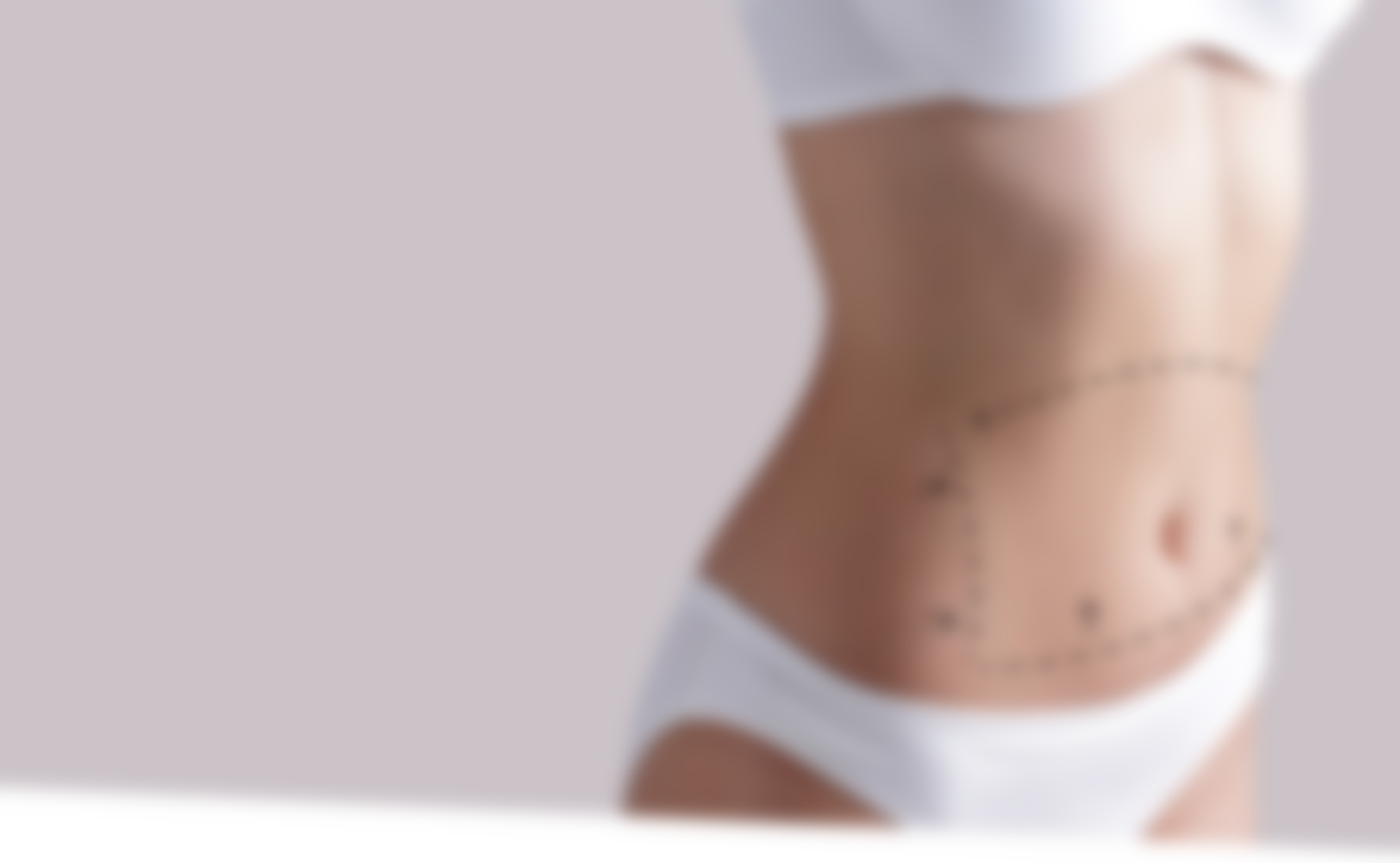 77 liposuction revision