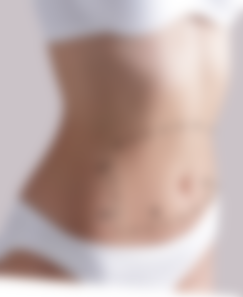 77 liposuction revision mobile