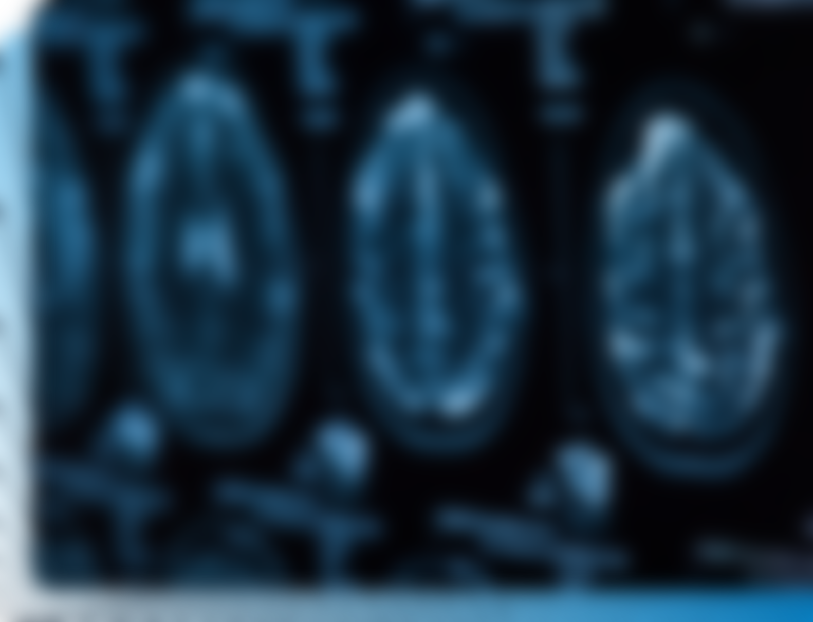 We treat neurological conditions