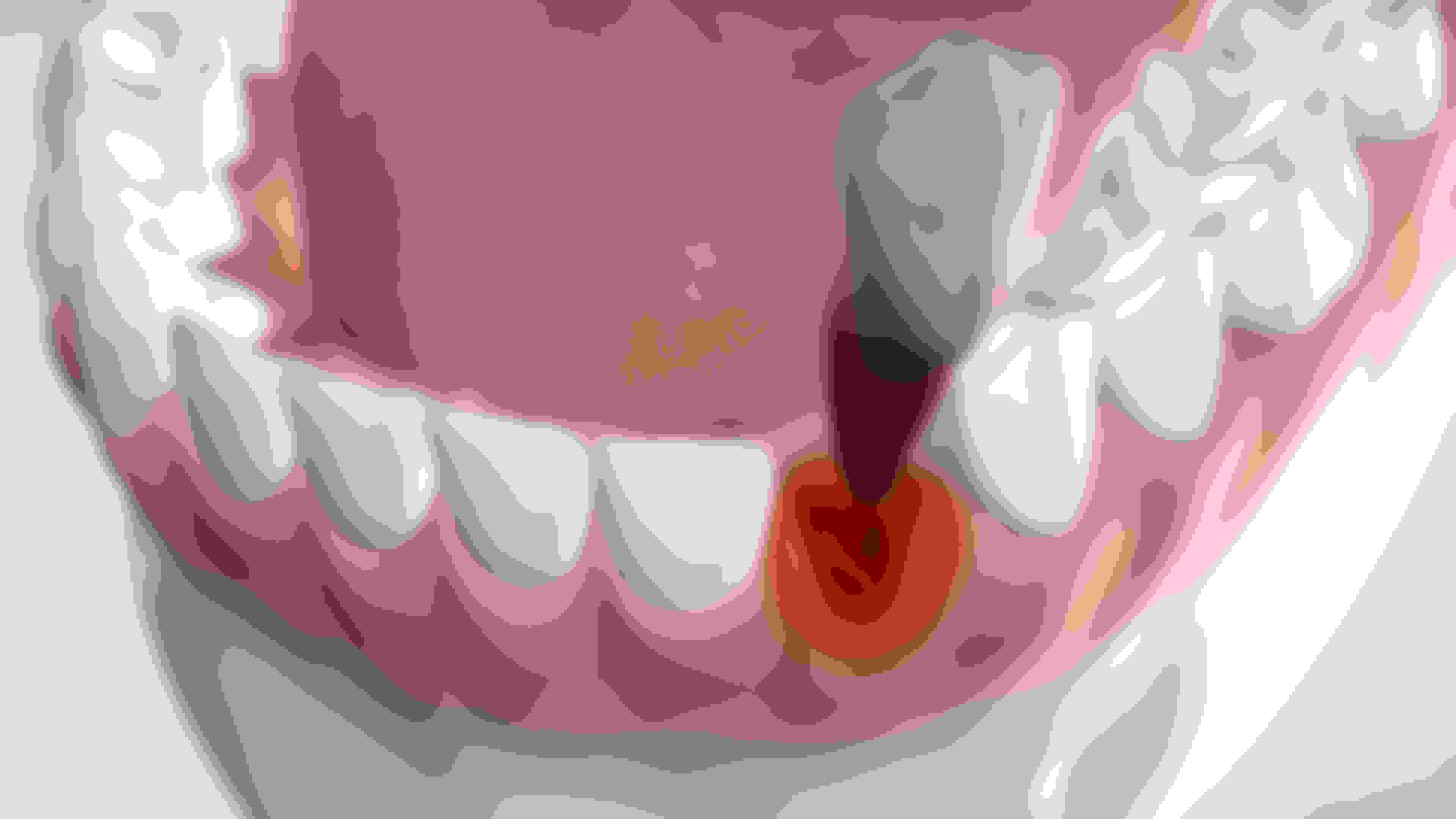 instruction  extraction