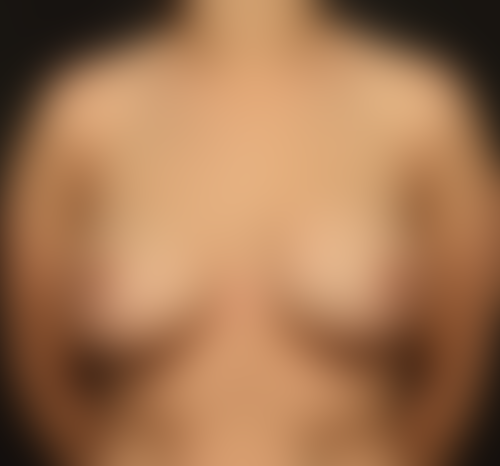 Query after patient 1