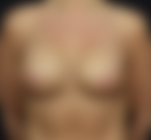 Query after patient 110