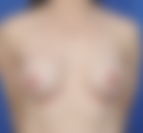 Query after patient 2