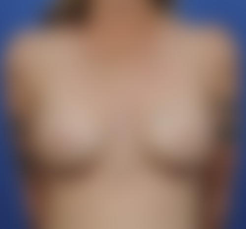 Query after patient 3