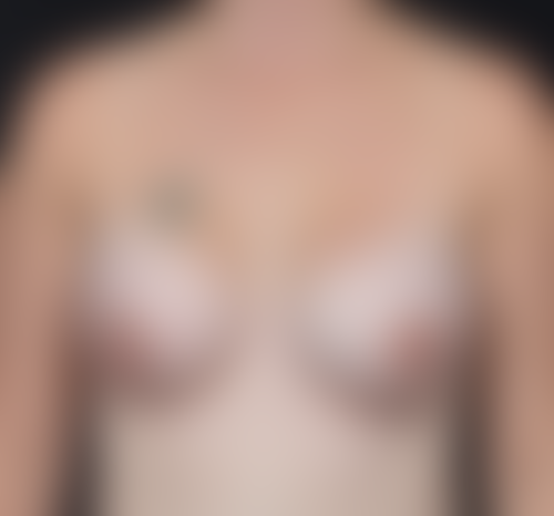 Query after patient 4