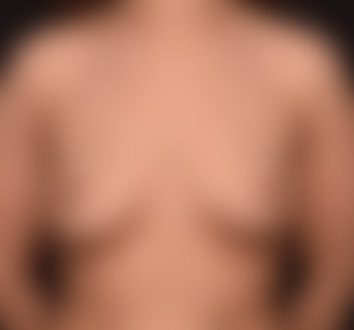 Query before patient 1