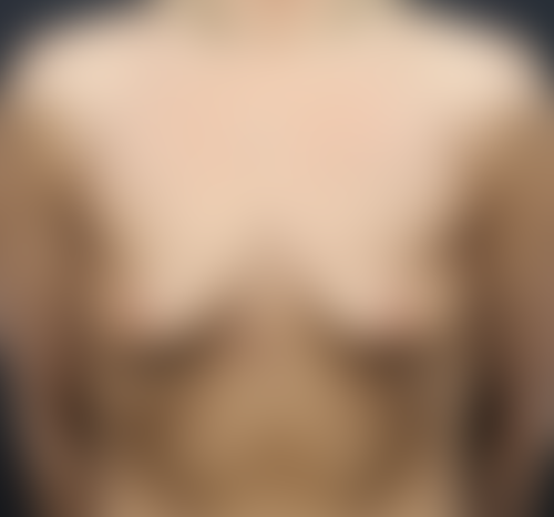 Query before patient 110