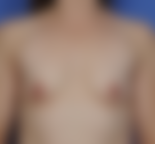 Query before patient 2