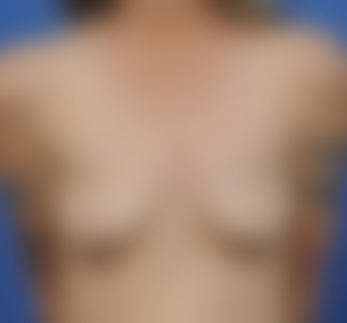 Query before patient 3