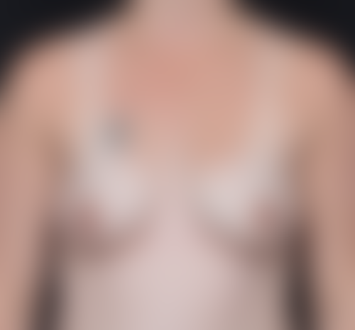 Query before patient 4