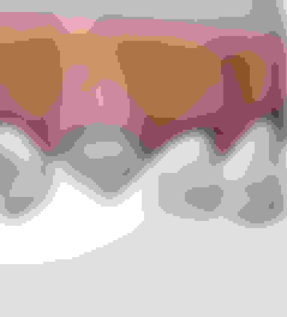 Query  expose and bond