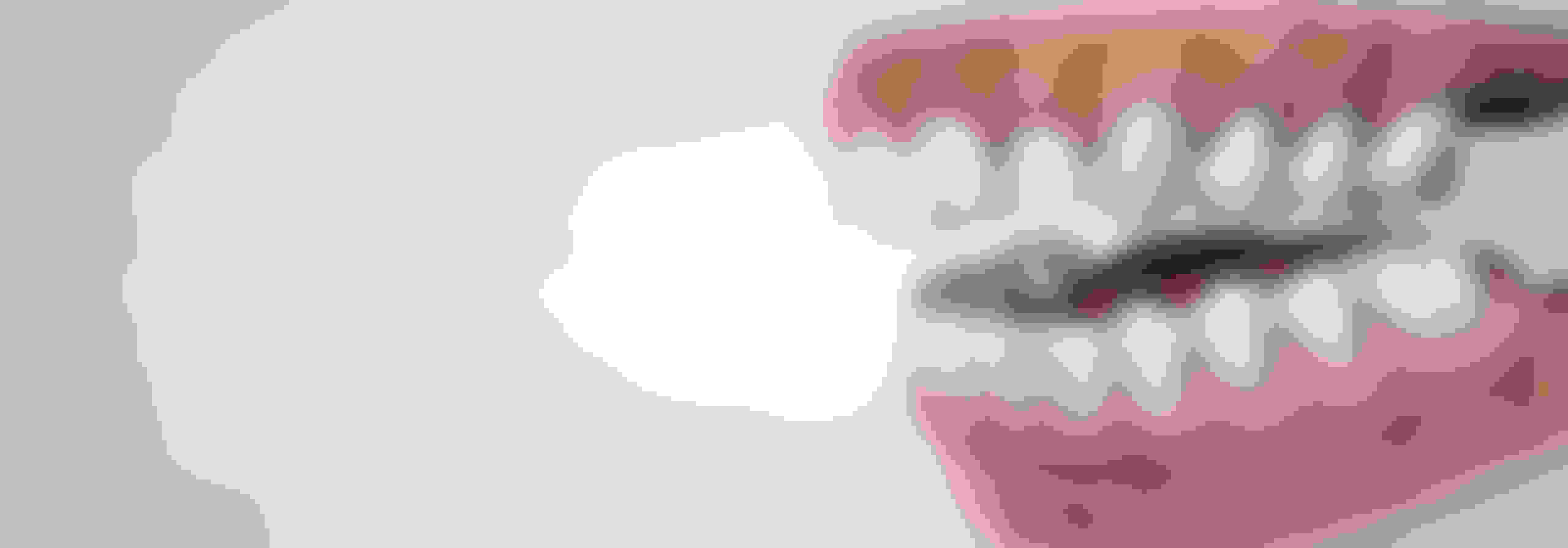 Pre prosthetic surgery procedure desktop