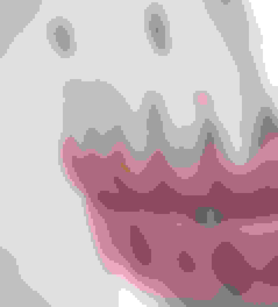 Query full arch restoration