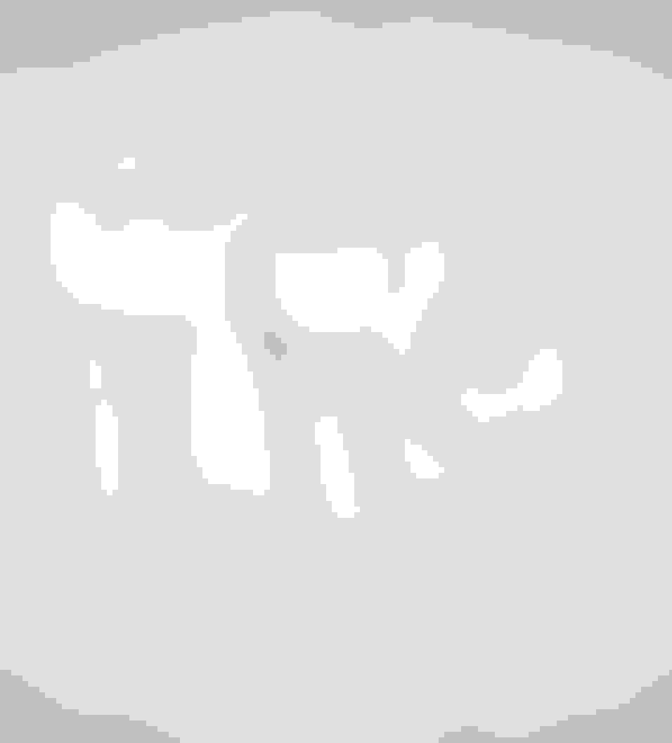 query  wisdom teeth removal