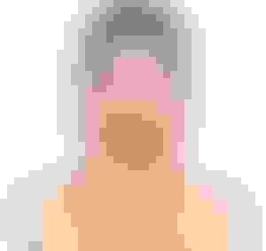 5 Botox Myths 300x283