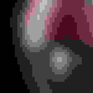 Dentalimplant3 2 300x300