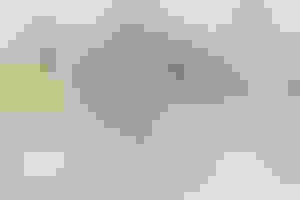 Types of facial trauma 300x200