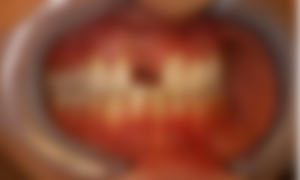 Case hope experience 10