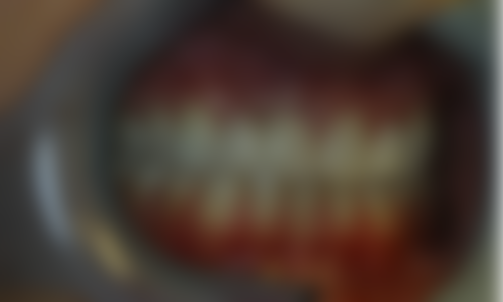 Case hope experience 11